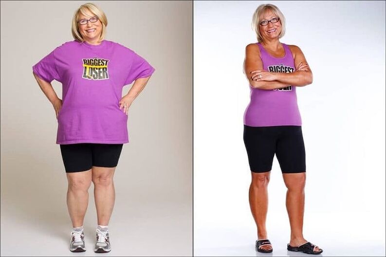 Mujeres antes y después de perder peso